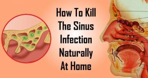 8 Powerful Roots And Plants To Drain Sinus Infection Naturally!