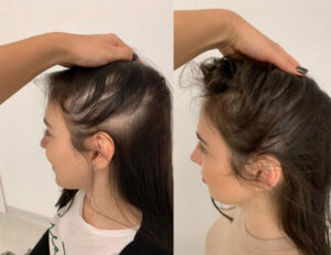 Beauty & Nail Parlor In Wharton NJ Discusses Hair Grow For Women