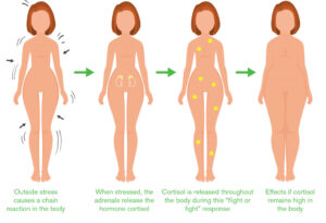 Weight Loss Specialist In Montville NJ Shows 5 Foods To Keep Cortisol Levels Down